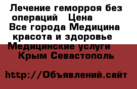 Лечение геморроя без операций › Цена ­ 300 - Все города Медицина, красота и здоровье » Медицинские услуги   . Крым,Севастополь